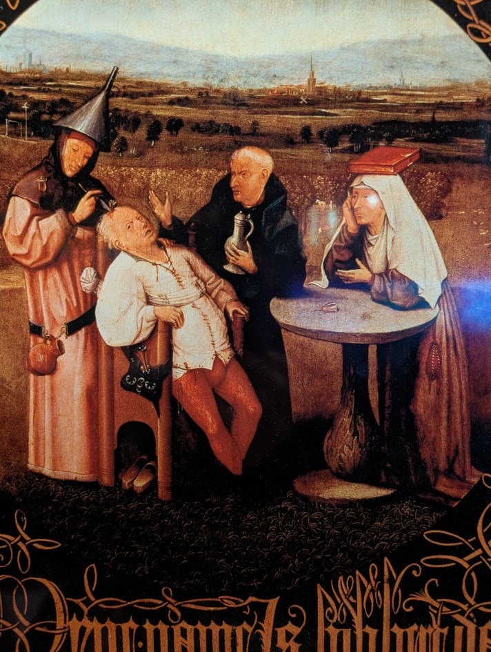 Cum a devenit lobotomia un simbol al erorilor din istoria psihiatriei